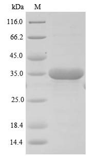 Mouse Sushi domain-containing protein 4 (Susd4), partial Recombinant Protein, N-10His, Mus musculus (Mouse), E.coli, N-terminal 10xHis-tagged, 37.0 kDa, purity >≥ 85% as determined by SDS-PAGE.