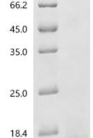 Human Bromodomain-containing protein 2 (BRD2), partial Recombinant Protein, N-IaN/C-His - BioCrest Sci