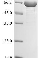 Human Schlafen family member 11 (SLFN11), partial Recombinant Protein - BioCrest Sci