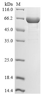 Human Schlafen family member 11 (SLFN11), partial Recombinant Protein, Homo sapiens (Human), E.coli, N-terminal 10xHis-tagged, 69.6 kDa, purity >≥ 85% as determined by SDS-PAGE.