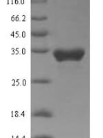 Human Transient receptor potential cation channel subfamily A member 1 (TRPA1), partial Recombinant Protein - BioCrest Sci