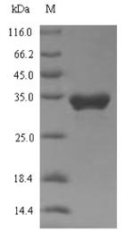 Human Transient receptor potential cation channel subfamily A member 1 (TRPA1), partial Recombinant Protein, Homo sapiens (Human), E.coli, N-terminal 6xHis-SUMO-tagged, 35.2 kDa, purity >≥ 90% as determined by SDS-PAGE.