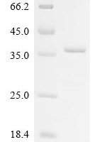 Pinctada fucata Mantle gene 8 Recombinant Protein - BioCrest Sci