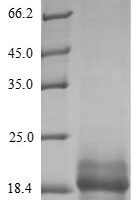 Human Small proline-rich protein 2B (SPRR2B) Recombinant Protein, N-10His/C-Myc - BioCrest Sci