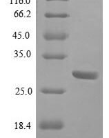 Human Bone morphogenetic protein 2 (BMP2) Recombinant Protein, N-His-SUMO - BioCrest Sci