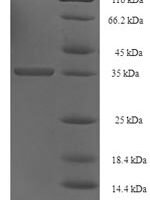 Human UPF0454 protein C12orf49 (C12orf49) Recombinant Protein - BioCrest Sci