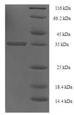 Human UPF0454 protein C12orf49 (C12orf49) Recombinant Protein, Homo sapiens (Human), E.coli, N-terminal 6xHis-SUMO-tagged, 35.7 kDa, purity >≥ 90% as determined by SDS-PAGE.