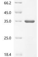 Cat Junctional adhesion molecule A (F11R), partial Recombinant Protein - BioCrest Sci