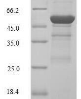 Human G1/S-specific cyclin-D2 (CCND2) Recombinant Protein, N-GST - BioCrest Sci