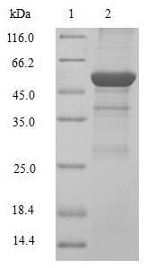 Human G1/S-specific cyclin-D2 (CCND2) Recombinant Protein, N-GST, Homo sapiens (Human), E.coli, N-terminal GST-tagged, 60.1 kDa, purity >≥ 90% as determined by SDS-PAGE.