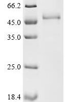Human papillomavirus type 16 Protein E7 (E7) Recombinant Protein, C-hFc1 - BioCrest Sci