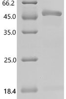 Mouse Adhesion G-protein coupled receptor G1 (Adgrg1), partial Recombinant Protein, C-His - BioCrest Sci