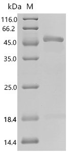 Mouse Adhesion G-protein coupled receptor G1 (Adgrg1), partial Recombinant Protein, C-His, Mus musculus (Mouse), E.coli, C-terminal 6xHis-tagged, 47.3 kDa, purity >≥ 85% as determined by SDS-PAGE.