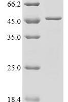 Mouse Hyaluronan and proteoglycan link protein 1 (Hapln1) Recombinant Protein, C-His - BioCrest Sci