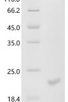 Mouse Inhibin beta C chain (Inhbc), partial Recombinant Protein - BioCrest Sci