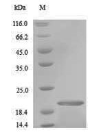 Ctenocephalides felis Salivary antigen 1 Recombinant Protein, N-His, aa 19–176, Yeast - BioCrest Sci