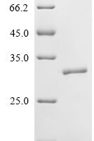 Human Neutrophil elastase (ELANE) Recombinant Protein, N-10His - BioCrest Sci