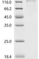 Human Seizure protein 6 homolog (SEZ6), partial Recombinant Protein, C-10His-HSA - BioCrest Sci