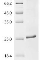 Rabbit Fibroblast growth factor 2 (FGF2) Recombinant Protein - BioCrest Sci