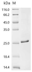 Rabbit Fibroblast growth factor 2 (FGF2) Recombinant Protein, Oryctolagus cuniculus (Rabbit), E.coli, C-terminal 6xHis-tagged, 23.3 kDa, purity >≥ 85% as determined by SDS-PAGE.