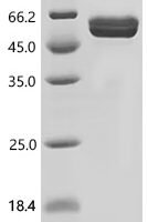 Mouse Filamin-C (Flnc), partial Recombinant Protein, C-hFc1 - BioCrest Sci