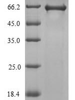 Agrobacterium fabrum Single-strand DNA-binding protein (virE2) Recombinant Protein - BioCrest Sci