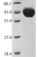 Human Putative pregnancy-specific beta-1-glycoprotein 7 (PSG7) Recombinant Protein, N-10His/C-Myc - BioCrest Sci