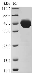 Human Putative pregnancy-specific beta-1-glycoprotein 7 (PSG7) Recombinant Protein, N-10His/C-Myc, Homo sapiens (Human), Baculovirus, N-terminal 10xHis-tagged and C-terminal Myc-tagged, 47.3 kDa, purity >≥ 85% as determined by SDS-PAGE.