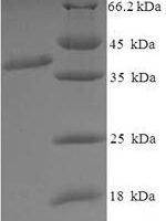 Mouse Excitatory amino acid transporter 2 (Slc1a2), partial Recombinant Protein, N-GST, aa 143–238, E.coli - BioCrest Sci