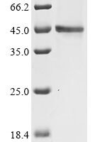 Human Actin, alpha skeletal muscle (ACTA1) Recombinant Protein - BioCrest Sci