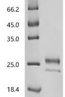 Human MHC class I polypeptide-related sequence B (MICB), partial Recombinant Protein, C-10His - BioCrest Sci