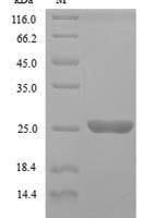 Saccharomyces cerevisiae GTP-binding protein YPT1 (YPT1) Recombinant Protein, N-His - BioCrest Sci