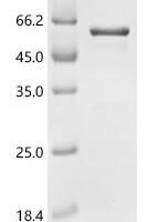 Human Paired box protein Pax-8 (PAX8) Recombinant Protein - BioCrest Sci