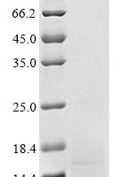 Human Tetraspanin-2 (TSPAN2), partial Recombinant Protein, C-His - BioCrest Sci