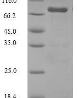 Human Steroid 17-alpha-hydroxylase/17,20 lyase (CYP17A1) Recombinant Protein, N-GST - BioCrest Sci
