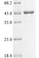Mouse Matrix metalloproteinase-21 (Mmp21) Recombinant Protein - BioCrest Sci