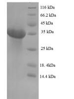 Bovine Erythropoietin (EPO) Recombinant Protein - BioCrest Sci