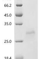 Cat Prolactin (PRL) Recombinant Protein, C-His, aa 31–229, Yeast - BioCrest Sci