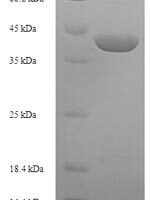 Trichosanthes kirilowii Ribosome-inactivating protein karasurin-C Recombinant Protein, N-His-SUMO - BioCrest Sci