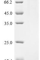 Human Fibulin-1 (FBLN1) Recombinant Protein, N-10His/C-Myc - BioCrest Sci