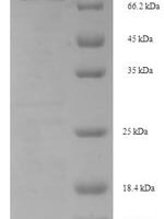 Human Centrosomal protein of 63 kDa (CEP63) Recombinant Protein - BioCrest Sci