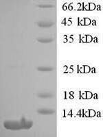 Human Type-1 angiotensin II receptor (AGTR1), partial Recombinant Protein, N-His - BioCrest Sci