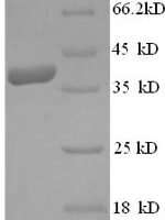 Human Vascular endothelial growth factor D (FIGF) Recombinant Protein - BioCrest Sci