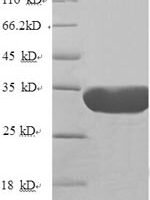 Human Nuclear pore membrane glycoprotein 210 (NUP210), partial Recombinant Protein - BioCrest Sci