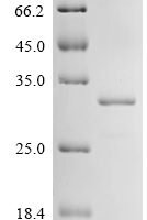 Drosophila melanogaster Clathrin heavy chain (Chc), partial Recombinant Protein - BioCrest Sci