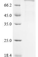 Human Succinate dehydrogenase [ubiquinone] flavoprotein subunit, mitochondrial  (SDHA), partial Recombinant Protein - BioCrest Sci