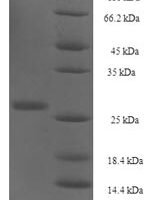 Human Protein yippee-like 1 (YPEL1) Recombinant Protein - BioCrest Sci