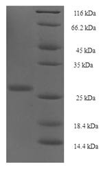 Human Protein yippee-like 1 (YPEL1) Recombinant Protein, Homo sapiens (Human), E.coli, N-terminal 6xHis-SUMO-tagged, 29.6 kDa, purity >≥ 90% as determined by SDS-PAGE.