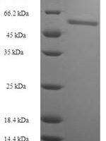 Human Acidic fibroblast growth factor intracellular-binding protein (FIBP) Recombinant Protein - BioCrest Sci