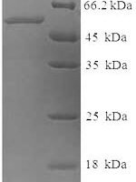 Human Tyrosinase (TYR), partial Recombinant Protein, N-His-SUMO - BioCrest Sci